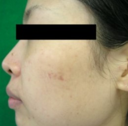 Before/After Image